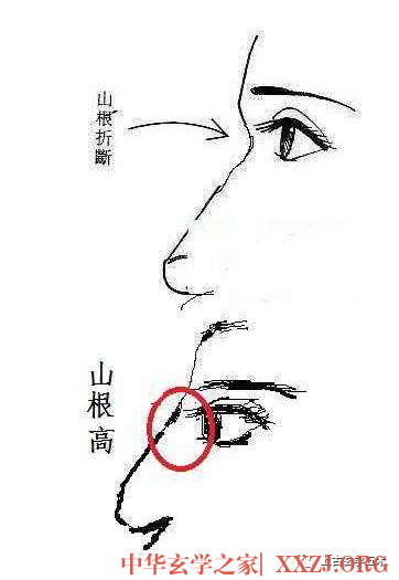 女人山根后天出现横纹是怎么回事【相人】 女人山根后天出现横纹是怎么回事【相人】