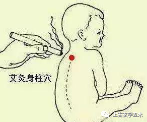 《小儿推拿广意》卷中>>泄泻门【推拿】 《小儿推拿广意》卷中>>泄泻门【推拿】