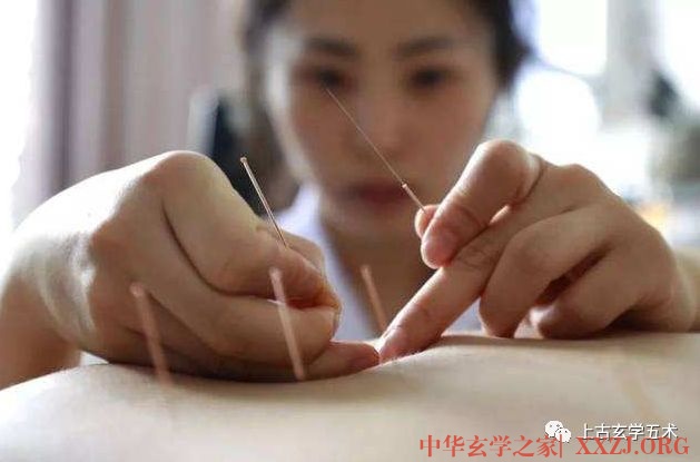 急症针灸的应用特点【针灸】 急症针灸的应用特点【针灸】