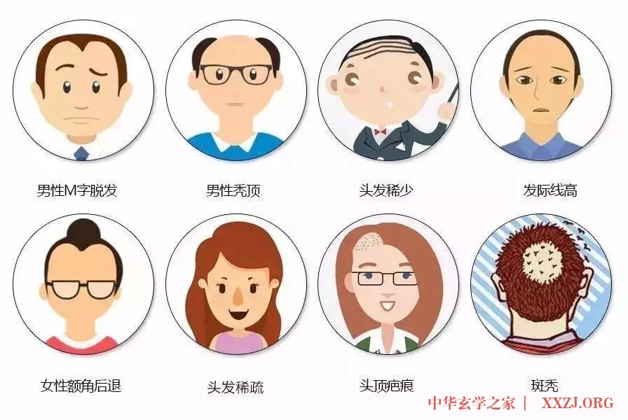 应对发白脱发,中医有妙招 应对发白脱发,中医有妙招